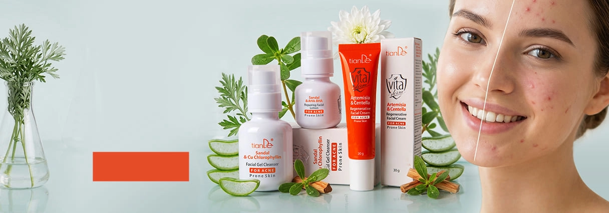 Controlul tenului predispus la acnee